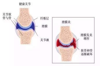 秋裤能脱了吗？