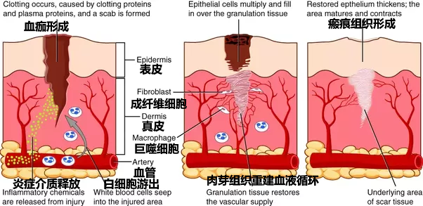 你的那些祛疤偏方真的靠谱吗？